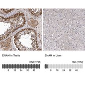 Anti-ENAH antibody produced in rabbit Prestige Antibodies® Powered by Atlas Antibodies, affinity isolated antibody, buffered aqueous glycerol solution, ab2