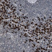 Anti-PRUNE2 antibody produced in rabbit Prestige Antibodies&#174; Powered by Atlas Antibodies, affinity isolated antibody, buffered aqueous glycerol solution