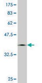 Monoclonal Anti-CMTM5 antibody produced in mouse clone 2G1-6B10, purified immunoglobulin, buffered aqueous solution