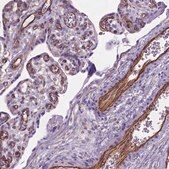 抗-AMOT 兔抗 Prestige Antibodies&#174; Powered by Atlas Antibodies, affinity isolated antibody, buffered aqueous glycerol solution