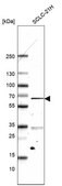 Monoclonal Anti-ETV1 antibody produced in mouse Prestige Antibodies® Powered by Atlas Antibodies, clone CL15251, purified antibody (Protein A)