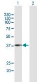 Anti-DCPS antibody produced in rabbit purified immunoglobulin, buffered aqueous solution