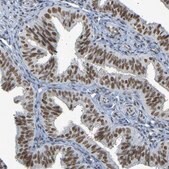 Anti-NELFB antibody produced in rabbit Prestige Antibodies&#174; Powered by Atlas Antibodies, affinity isolated antibody, buffered aqueous glycerol solution