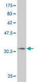 ANTI-NMI antibody produced in mouse clone 9E8, purified immunoglobulin, buffered aqueous solution