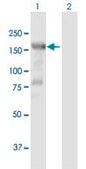 Anti-HDAC6 antibody produced in mouse purified immunoglobulin, buffered aqueous solution