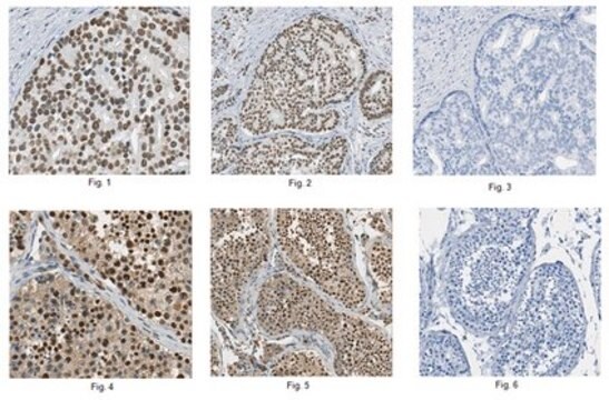 Anti-Ku70 Protein Antibody from rabbit