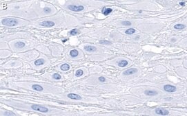 Anti-DHX37 Antibody, clone 3I16 ZooMAb® Rabbit Monoclonal recombinant, expressed in HEK 293 cells