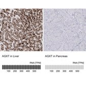 Anti-AGXT antibody produced in rabbit Prestige Antibodies® Powered by Atlas Antibodies, affinity isolated antibody, buffered aqueous glycerol solution
