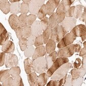 Anti-PPP1R3B antibody produced in rabbit Prestige Antibodies&#174; Powered by Atlas Antibodies, affinity isolated antibody, buffered aqueous glycerol solution