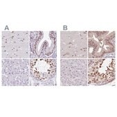 Anti-DR1 antibody produced in rabbit Prestige Antibodies® Powered by Atlas Antibodies, affinity isolated antibody, buffered aqueous glycerol solution
