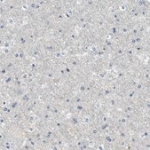 Anti-MYO1G antibody produced in rabbit Prestige Antibodies® Powered by Atlas Antibodies, affinity isolated antibody, buffered aqueous glycerol solution