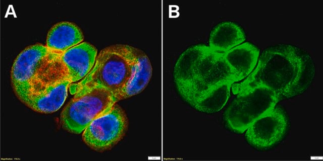 Anti-LYVE1 Antibody, clone 2F9 ZooMAb&#174; Rabbit Monoclonal recombinant, expressed in HEK 293 cells