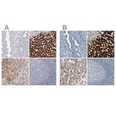 Anti-CYP2E1 antibody produced in rabbit Prestige Antibodies® Powered by Atlas Antibodies, affinity isolated antibody, buffered aqueous glycerol solution