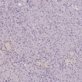Anti-CSE1L antibody produced in rabbit Prestige Antibodies&#174; Powered by Atlas Antibodies, affinity isolated antibody, buffered aqueous glycerol solution