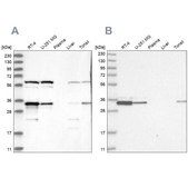 Anti-PRKRA antibody produced in rabbit Prestige Antibodies® Powered by Atlas Antibodies, affinity isolated antibody