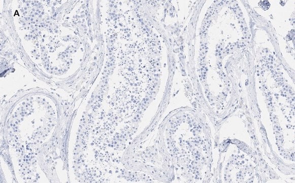 抗-GAPDH抗体，克隆10B13，ZooMAb&#174;兔单克隆抗体 recombinant, expressed in HEK 293 cells