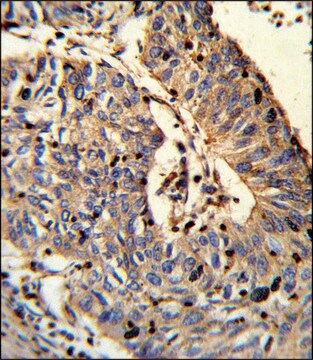 ANTI-C21ORF29 (CENTER) antibody produced in rabbit IgG fraction of antiserum, buffered aqueous solution