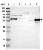 Anti-ICA1 antibody produced in rabbit Prestige Antibodies&#174; Powered by Atlas Antibodies, affinity isolated antibody, buffered aqueous glycerol solution