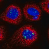 Anti-DDX27 antibody produced in rabbit Prestige Antibodies&#174; Powered by Atlas Antibodies, affinity isolated antibody, buffered aqueous glycerol solution