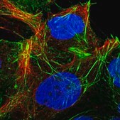 Anti-CYP20A1 antibody produced in rabbit Prestige Antibodies&#174; Powered by Atlas Antibodies, affinity isolated antibody, buffered aqueous glycerol solution