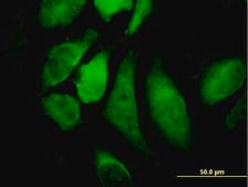 Monoclonal Anti-CHUK, (C-terminal) antibody produced in mouse clone 2G4, purified immunoglobulin, buffered aqueous solution