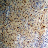 Anti-phospho-p53 (pSer15) antibody produced in rabbit affinity isolated antibody