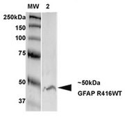 Monoclonal Anti-Lrrk2/Dardarin - Biotin antibody produced in mouse clone S231B-34, purified immunoglobulin