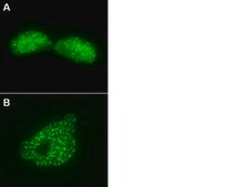 LentiBrite GFP-Rad51 Lentiviral Biosensor