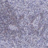 Anti-SEPT1 antibody produced in rabbit Prestige Antibodies® Powered by Atlas Antibodies, affinity isolated antibody, buffered aqueous glycerol solution