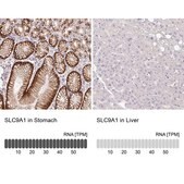 Anti-SLC9A1 antibody produced in rabbit Prestige Antibodies® Powered by Atlas Antibodies, affinity isolated antibody, buffered aqueous glycerol solution
