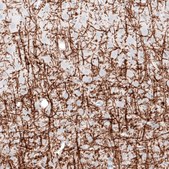 Monoclonal Anti-PLP1 antibody produced in mouse Prestige Antibodies® Powered by Atlas Antibodies, clone CL10622, purified antibody (Protein A)