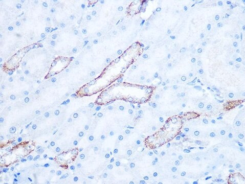 Anti-IRAK2 antibody produced in rabbit