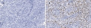 Anti-p21 Antibody, clone 5G7, ZooMAb&#174; Rabbit Monoclonal recombinant, expressed in HEK 293 cells