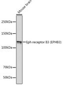 Anti-Eph receptor B3 (EPHB3) Antibody, clone 8H9P4, Rabbit Monoclonal