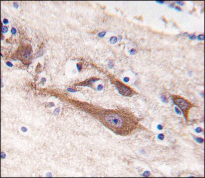 Anti-NCS1 (center) antibody produced in rabbit IgG fraction of antiserum, buffered aqueous solution