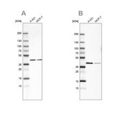 Anti-SORD antibody produced in rabbit Prestige Antibodies&#174; Powered by Atlas Antibodies, affinity isolated antibody, buffered aqueous glycerol solution