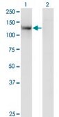 Monoclonal Anti-SDCCAG33 antibody produced in mouse clone 2F1, purified immunoglobulin, buffered aqueous solution
