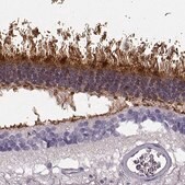 Anti-GRK1 antibody produced in rabbit Prestige Antibodies&#174; Powered by Atlas Antibodies, affinity isolated antibody