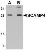 Anti-SCAMP4 antibody produced in rabbit affinity isolated antibody, buffered aqueous solution