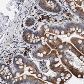 Anti-DERL1 antibody produced in rabbit Prestige Antibodies&#174; Powered by Atlas Antibodies, affinity isolated antibody, buffered aqueous glycerol solution