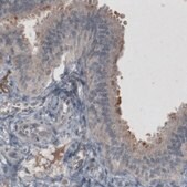 Monoclonal Anti-MUC16 antibody produced in mouse Prestige Antibodies&#174; Powered by Atlas Antibodies, clone CL2783, purified immunoglobulin
