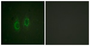 Anti-Connexin 43 antibody produced in rabbit affinity isolated antibody