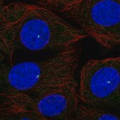 Anti-MZT2A antibody produced in rabbit Prestige Antibodies&#174; Powered by Atlas Antibodies, affinity isolated antibody, buffered aqueous glycerol solution