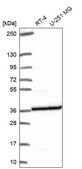 Anti-RPL5 antibody produced in rabbit Prestige Antibodies&#174; Powered by Atlas Antibodies, affinity isolated antibody