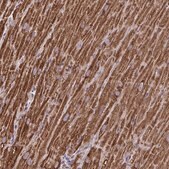 Anti-MT-ND3 antibody produced in rabbit Prestige Antibodies® Powered by Atlas Antibodies, affinity isolated antibody, buffered aqueous glycerol solution