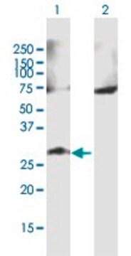 Anti-GALNT9 antibody produced in mouse purified immunoglobulin, buffered aqueous solution