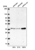 Anti-RPP38 antibody produced in rabbit Prestige Antibodies® Powered by Atlas Antibodies, affinity isolated antibody, buffered aqueous glycerol solution