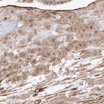 Anti-ZGRF1 antibody produced in rabbit Prestige Antibodies&#174; Powered by Atlas Antibodies, affinity isolated antibody, buffered aqueous glycerol solution