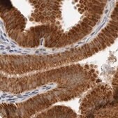 Anti-DYRK4 antibody produced in rabbit Prestige Antibodies&#174; Powered by Atlas Antibodies, affinity isolated antibody, buffered aqueous glycerol solution