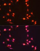 Anti-S100B antibody produced in rabbit